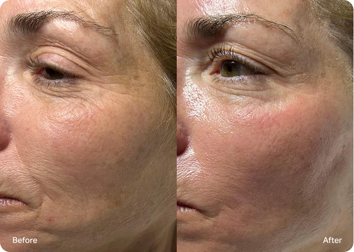 Elara Skin customer review