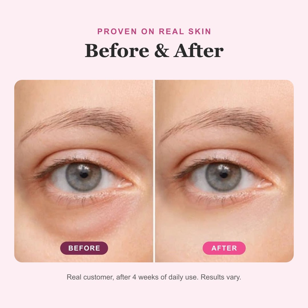 ELARA balm view 4